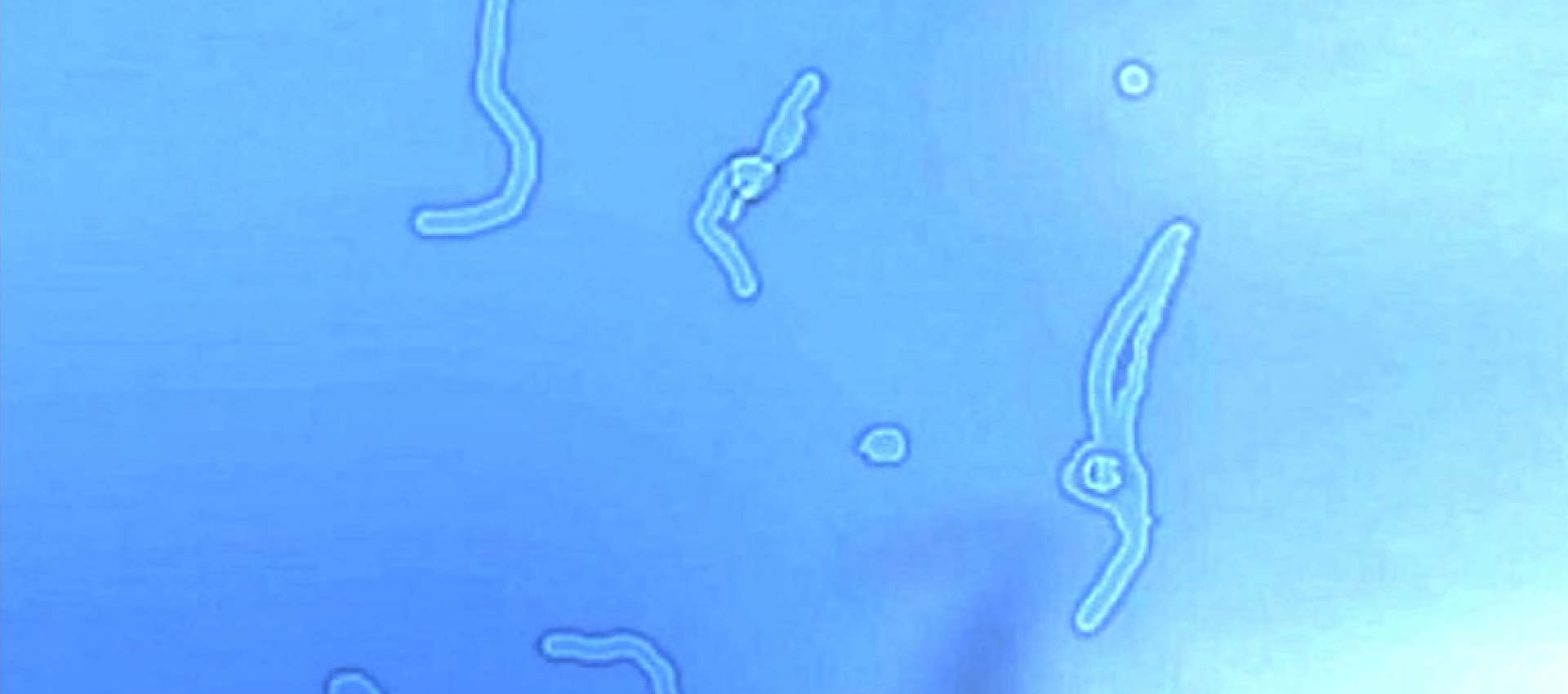 COSA SONO LE “MOSCHE VOLANTI”? SI POSSONO CONTRASTARE?